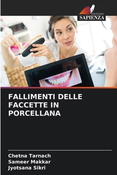 Paperback Fallimenti Delle Faccette in Porcellana [Italian] Book