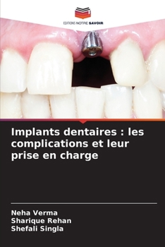 Impianti dentali: complicanze e loro gestione