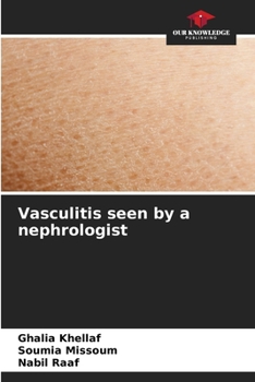 Paperback Vasculitis seen by a nephrologist Book