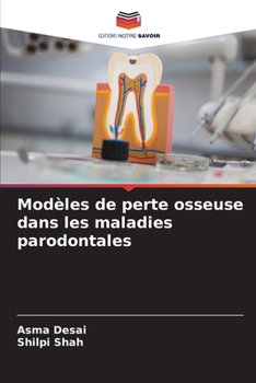 Paperback Modèles de perte osseuse dans les maladies parodontales [French] Book