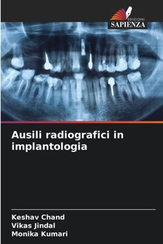 Paperback Ausili radiografici in implantologia [Italian] Book