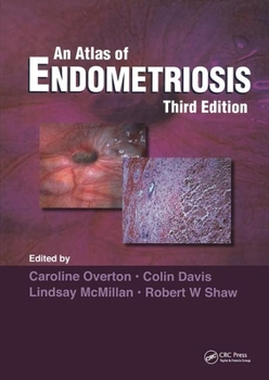 Hardcover Atlas of Endometriosis Book