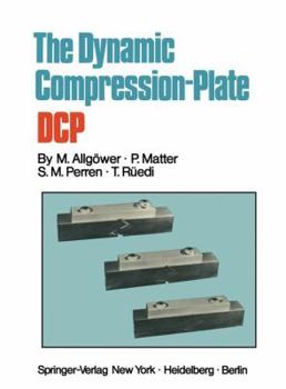 Paperback The Dynamic Compression Plate Dcp Book