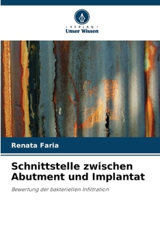 Paperback Schnittstelle zwischen Abutment und Implantat [German] Book