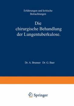 Paperback Die Chirurgische Behandlung Der Lungentuberkulose: Erfahrungen Und Kritische Betrachtungen [German] Book