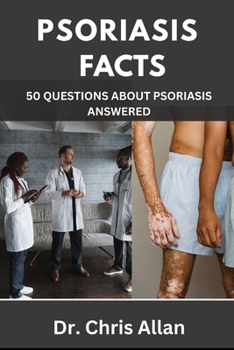 Paperback Psoriasis Facts: 50 Questions about Psoriasis Answered. Book