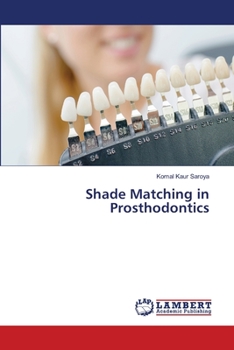 Paperback Shade Matching in Prosthodontics Book