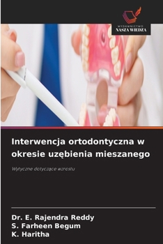 Interwencja ortodontyczna w okresie uzebienia mieszanego (Polish Edition)