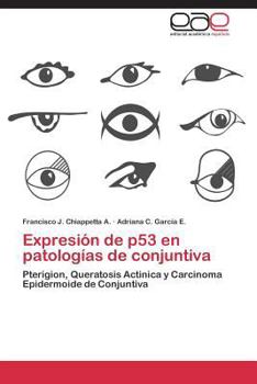 Paperback Expresion de P53 En Patologias de Conjuntiva [Spanish] Book