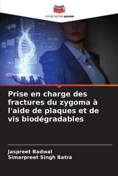 Prise en charge des fractures du zygoma à l'aide de plaques et de vis biodégradables (French Edition)