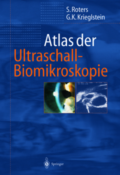 Paperback Atlas Der Ultraschall-Biomikroskopie [German] Book