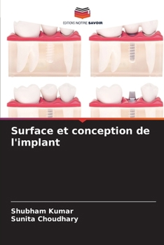 Paperback Surface et conception de l'implant [French] Book