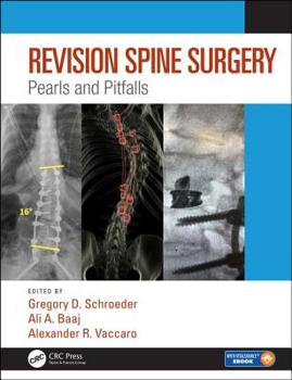 Hardcover Revision Spine Surgery: Pearls and Pitfalls Book