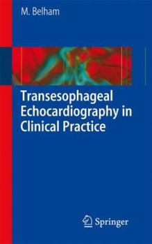 Paperback Transesophageal Echocardiography in Clinical Practice Book