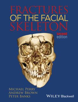 Paperback Fractures of the Facial Skeleton Book