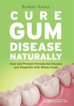 Paperback Cure Gum Disease Naturally: Heal Gingivitis and Periodontal Disease with Whole Foods Book