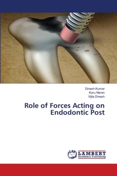 Paperback Role of Forces Acting on Endodontic Post Book