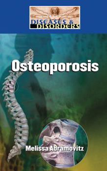 Library Binding Osteoporosis Book