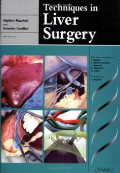 Hardcover Techniques in Liver Surgery (Greenwich Medical Media) Book