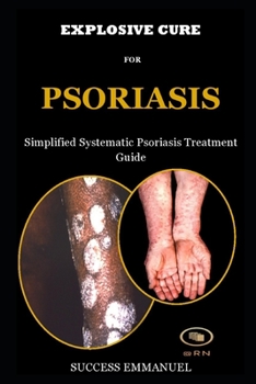 Paperback Explosive Cure for Psoriasis: Simplified Systematic Psoriasis Treatment Guide Book