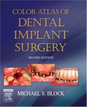 Hardcover Color Atlas of Dental Implant Surgery Book