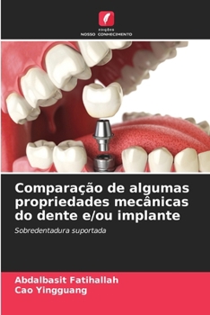 Paperback Comparação de algumas propriedades mecânicas do dente e/ou implante [Portuguese] Book