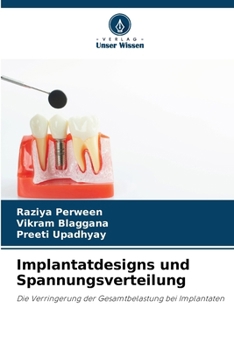 Paperback Implantatdesigns und Spannungsverteilung [German] Book