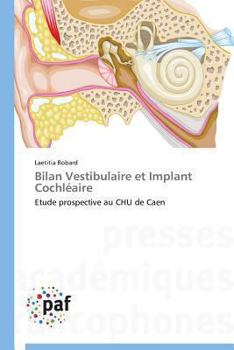 Paperback Bilan Vestibulaire Et Implant Cochléaire [French] Book