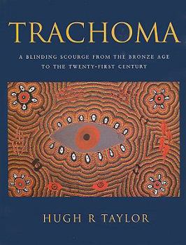 Hardcover Trachoma: A Blinding Scourge from the Bronze Age to the Twenty-First Century Book