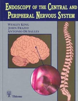 Hardcover Endoscopy of the Central and Peripheral Nervous System: Book