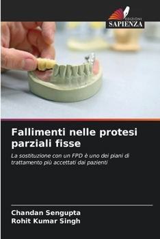 Paperback Fallimenti nelle protesi parziali fisse [Italian] Book