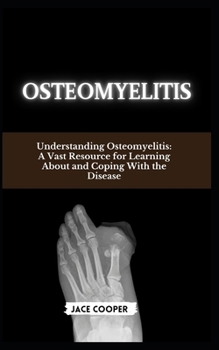 Paperback Osteomyelitis: Understanding Osteomyelitis: A Vast Resource for Learning About and Coping With the Disease Book