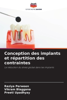 Paperback Conception des implants et répartition des contraintes [French] Book