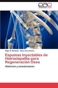 Paperback Espumas Inyectables de Hidroxiapatita para Regeneración Ósea [Spanish] Book