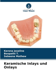 Paperback Keramische Inlays und Onlays [German] Book