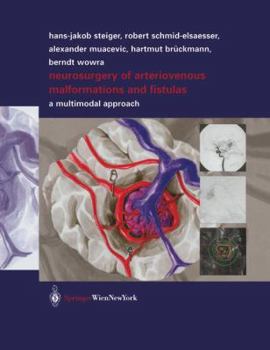 Hardcover Neurosurgery of Arteriovenous Malformations and Fistulas: A Multimodal Approach Book