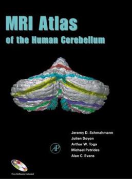 Hardcover MRI Atlas of the Human Cerebellum [With CDROM] Book