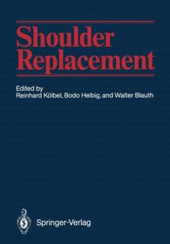 Paperback Shoulder Replacement Book