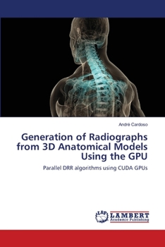 Paperback Generation of Radiographs from 3D Anatomical Models Using the GPU Book