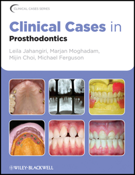 Paperback Clinical Cases in Prosthodontics Book