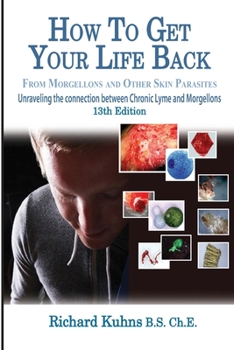 Paperback How to Get Your Life Back From Morgellons and Other Skin Parasites Limited Edit Book