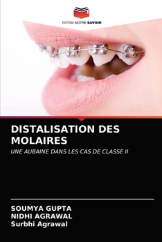 Paperback Distalisation Des Molaires [French] Book