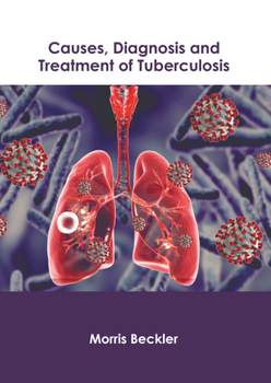 Hardcover Causes, Diagnosis and Treatment of Tuberculosis Book