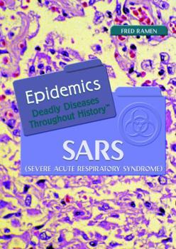 Library Binding Sars (Severe Acute Respiratory Syndrome) Book