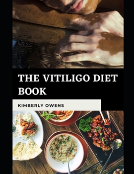Paperback The Vitiligo Diet Book: Discover Several Easy and Delicious Recipes for Vitiligo Book