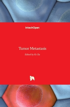 Hardcover Tumor Metastasis Book