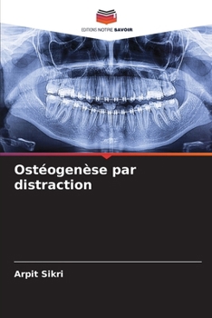 Paperback Ostéogenèse par distraction [French] Book