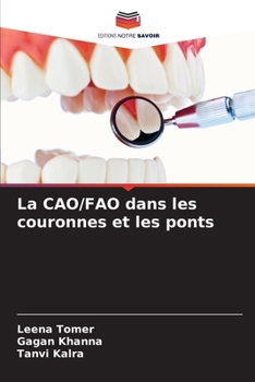 Paperback La CAO/FAO dans les couronnes et les ponts [French] Book