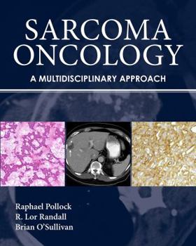 Hardcover Sarcoma Oncology: A Multidisciplinary Approach Book