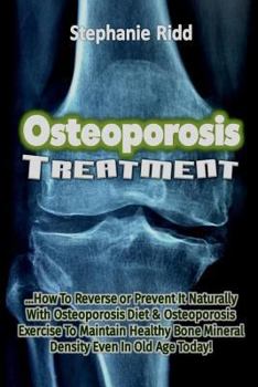Paperback Osteoporosis Treatment: How To Reverse or Prevent It Naturally With Osteoporosis Diet And Osteoporosis Exercise To Maintain Healthy Bone Miner Book